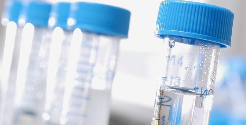 EU Committees Amend SPC Manufacturing Waiver, Push Access To Generics, Biosimilars